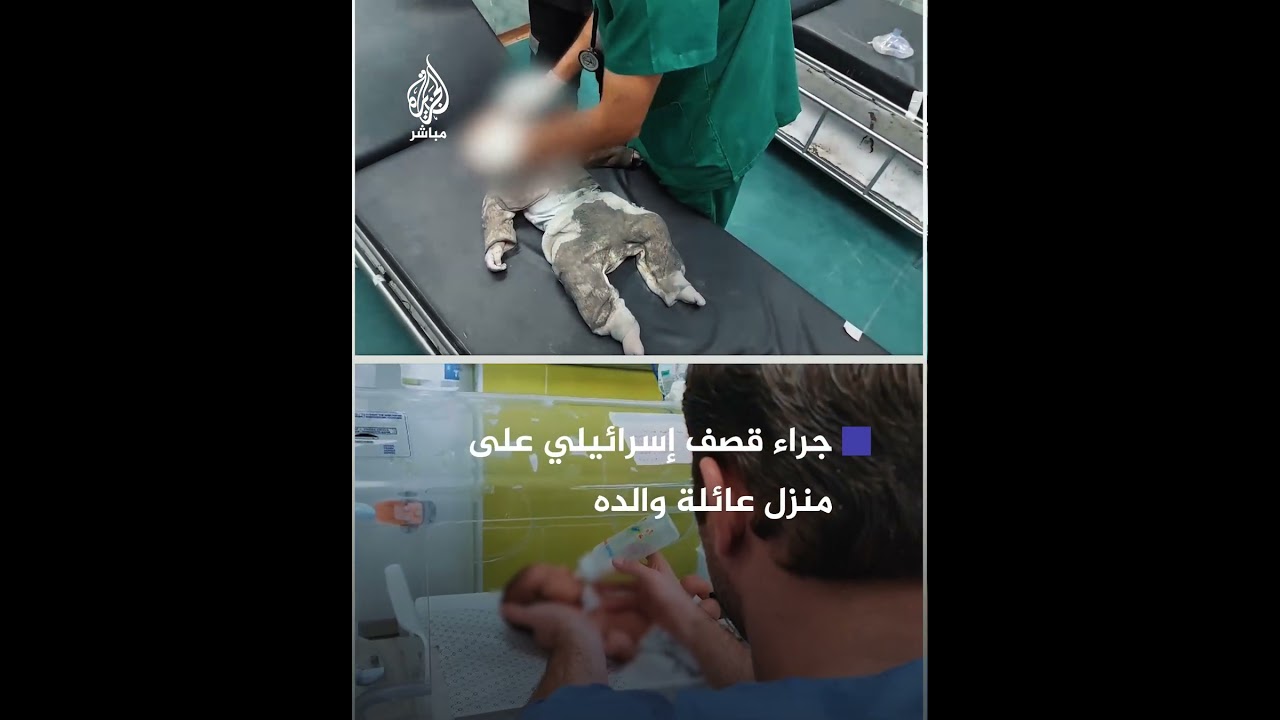 استـشـ ـهاد الرضيع هاني قشطة الذي استخرج من بطن والدته الشـهــيـ دة في أكتوبر 2023 إثر قصـف إسرائيلي