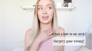 STORYTIME: Ice cream came out of a hole in my neck!? (Surgery gone wrong)