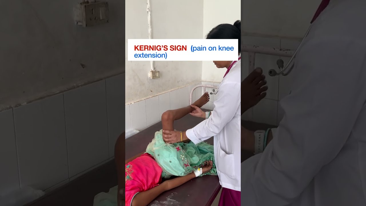 How To Check For The Signs Of Meningeal Irritation Meningitis