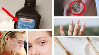 7 Surprising Uses For Hydrogen Peroxide