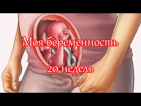 20 Неделя Беременности Фото Форум