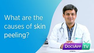 What Are The Causes Of Skin Peeling?