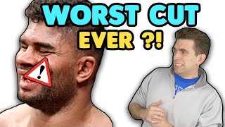 HIS LIP RIPPED OPEN! Doctor Reacts to WORST Cut in UFC History? - Alistair Overeem