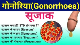 सूजाक रोग | Gonorrhea- Causes, Symptoms, Diagnosis, Treatment | Gonorrhea disease | sujak rog | STD