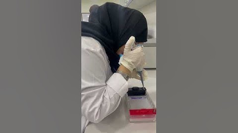Sample loading (agarose gel electrophoresis)