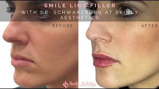 PDO Special - Skinly Aesthetics