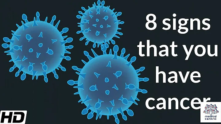 When should you suspect you have cancer? (2023)