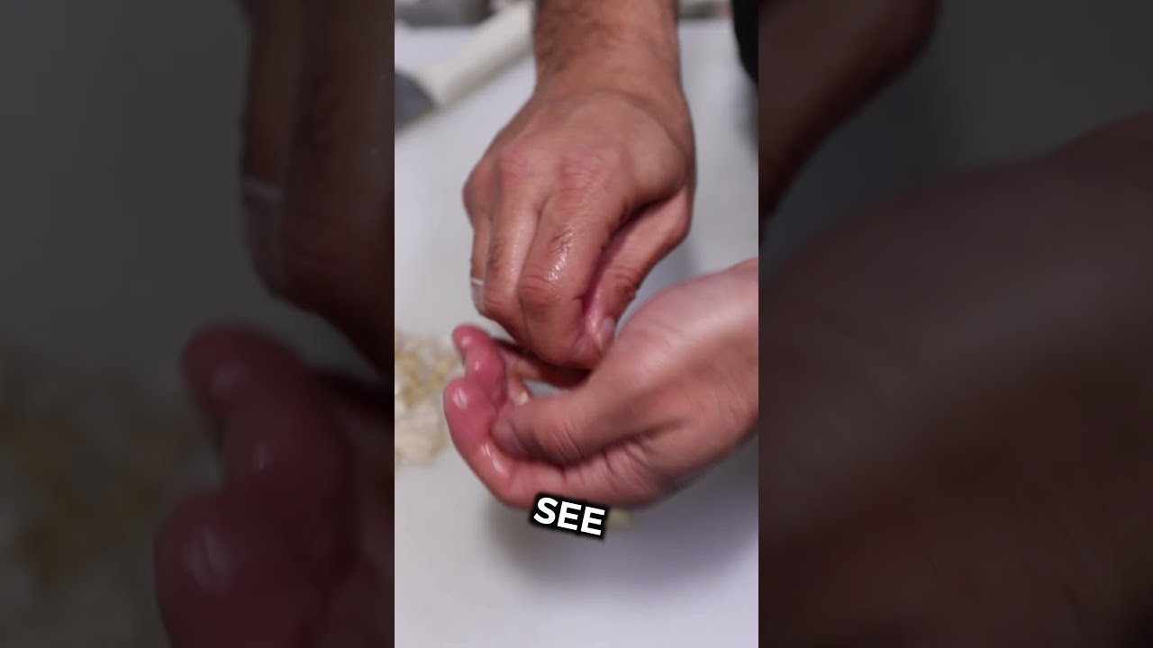 Kitchen Hack For Easy Garlic Peeling