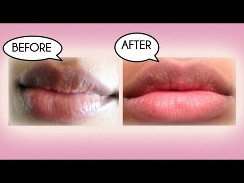 How to Lighten Dark Lips Naturally