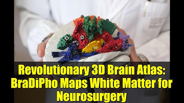 Revolutionary 3D Brain Atlas: BraDiPho Maps White Matter for Neurosurgery