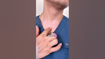 2 Cách cải thiện sẹo lồi sau cắt tuyến giáp #tuyengiap #ungthutuyengiap