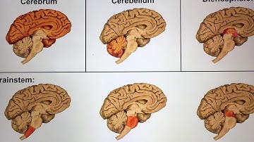 Chapter 14: The Brain and Cranial Nerves: Brain Anatomy (Part 1) (Video 2)