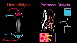 Basics of Dialysis and Modalities