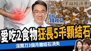 【健康】吃這些狂降壞膽固醇？名醫曝5超級食物消除膽結石：沒開刀3個月全消失！ft.錢政弘醫師｜下班經濟學453