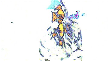 Delete Insert - Copy Write