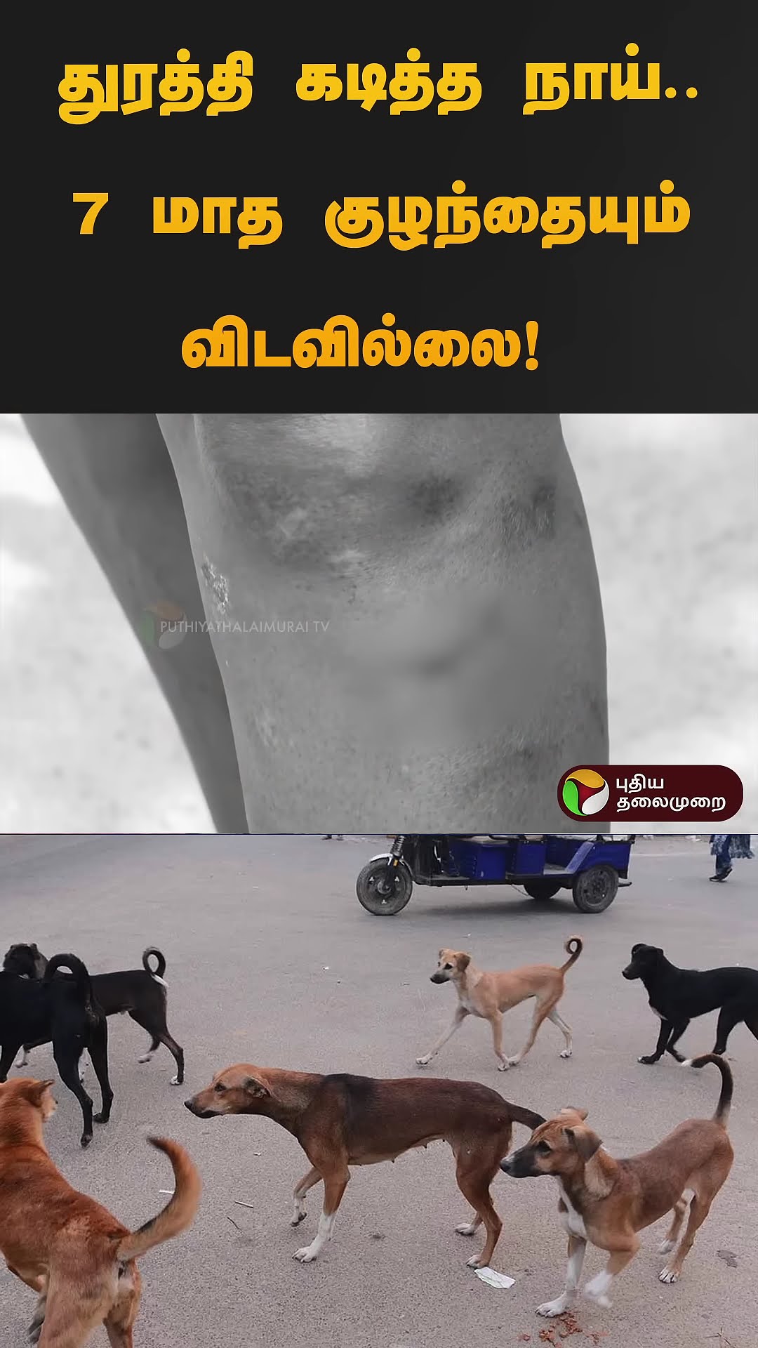 துரத்தி துரத்தி கடித்த நாய்..7 மாத குழந்தையும் விடவில்லை! VELACHERY DOG Bite | #shorts