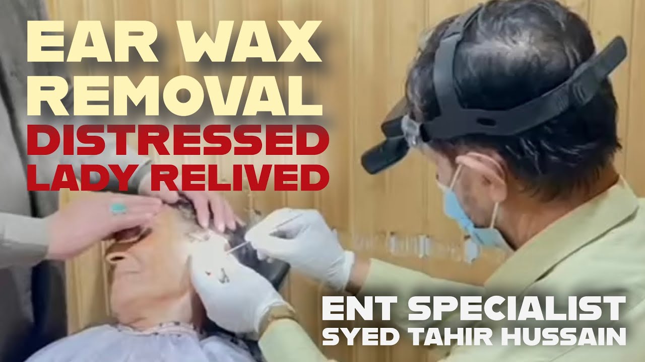 Vertigo After Ear Wax Removal