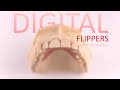 Digital flippers  image dental laboratory