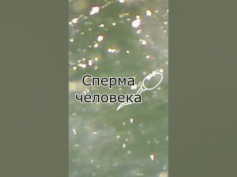 Сперма под микроскопом №1 #shorts - YouTube