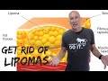 Lion diet rid my body of lipomas without surgery