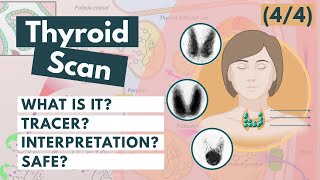 Thyroid Scan & Radioactive Iodine | Nuclear medicine | Visual Explanation