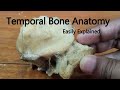 Surgical anatomy of temporal bone points to know before mastoid surgery  temporal bone dissection