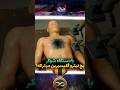 با دتگاه شوکر پچ نیترو گلیسیرین میترکه با دتگاه شوکر پچ نیترو گلیسیرین میترکه