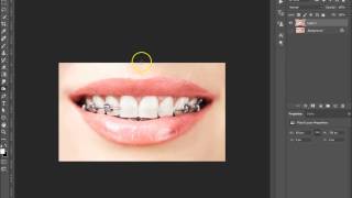 Photoshop Tutorial | How to remove Braces screenshot 5