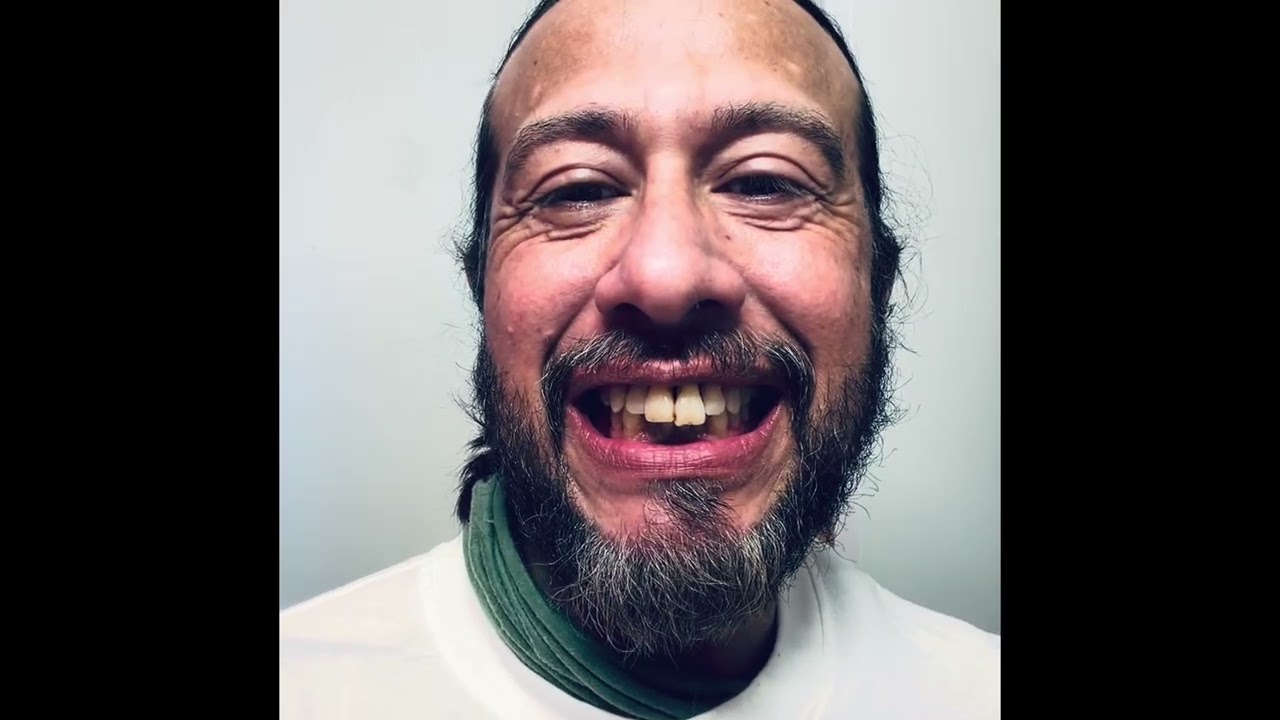 The Day of Action Teeth Removal Part 2 Oral Surgery 