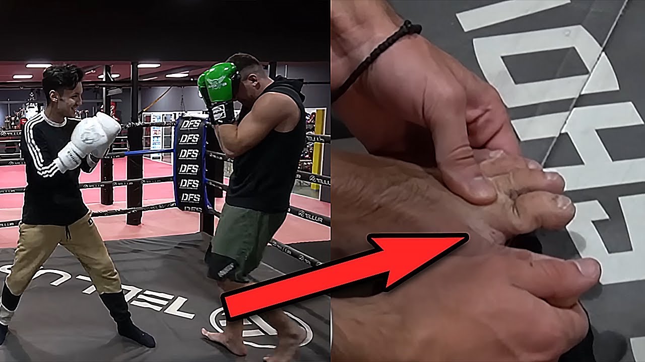 Alex Alvarez Si-a Rupt Degetul si Si-a Luat Bataie 😂😂