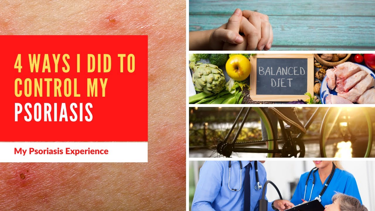 How to Control Psoriasis YouTube