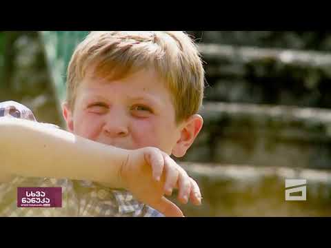 სხვა ნანუკა -  გურული ბაღანა