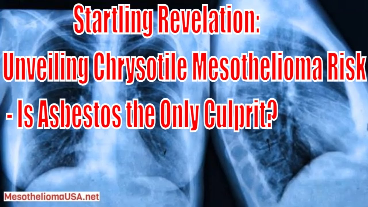 Chrysotile Mesothelioma Risk - Is Mesothelioma Always Caused by Asbestos Exposure?