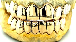 Gold grillz vs White Gold Grillz Vs Silver Grillz