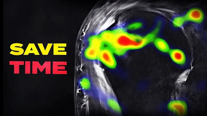 My 7-Second Habit ALL Radiologists Need To Know