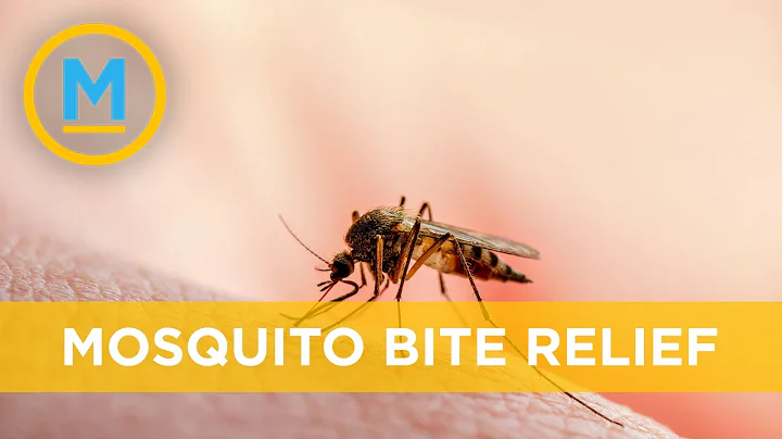 Home remedies to help with itchy mosquito bites | Your Morning - DayDayNews