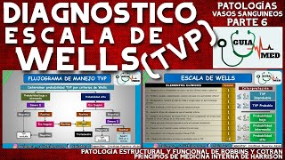 WELLS SCALE DEEP VEIN THROMBOSIS | GuiaMed WELLS SCALE DEEP VEIN THROMBOSIS | GuiaMed