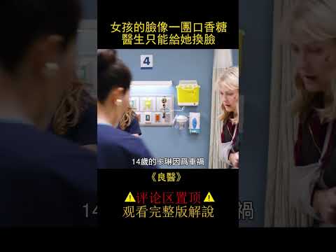 女孩毀容，醫生卻打算給她換上一張死人的臉《良醫》