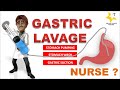 Gastric Lavage Procedure |  Stomach Wash | Gastric suction | Stomach Pumping| Nursing Procedure