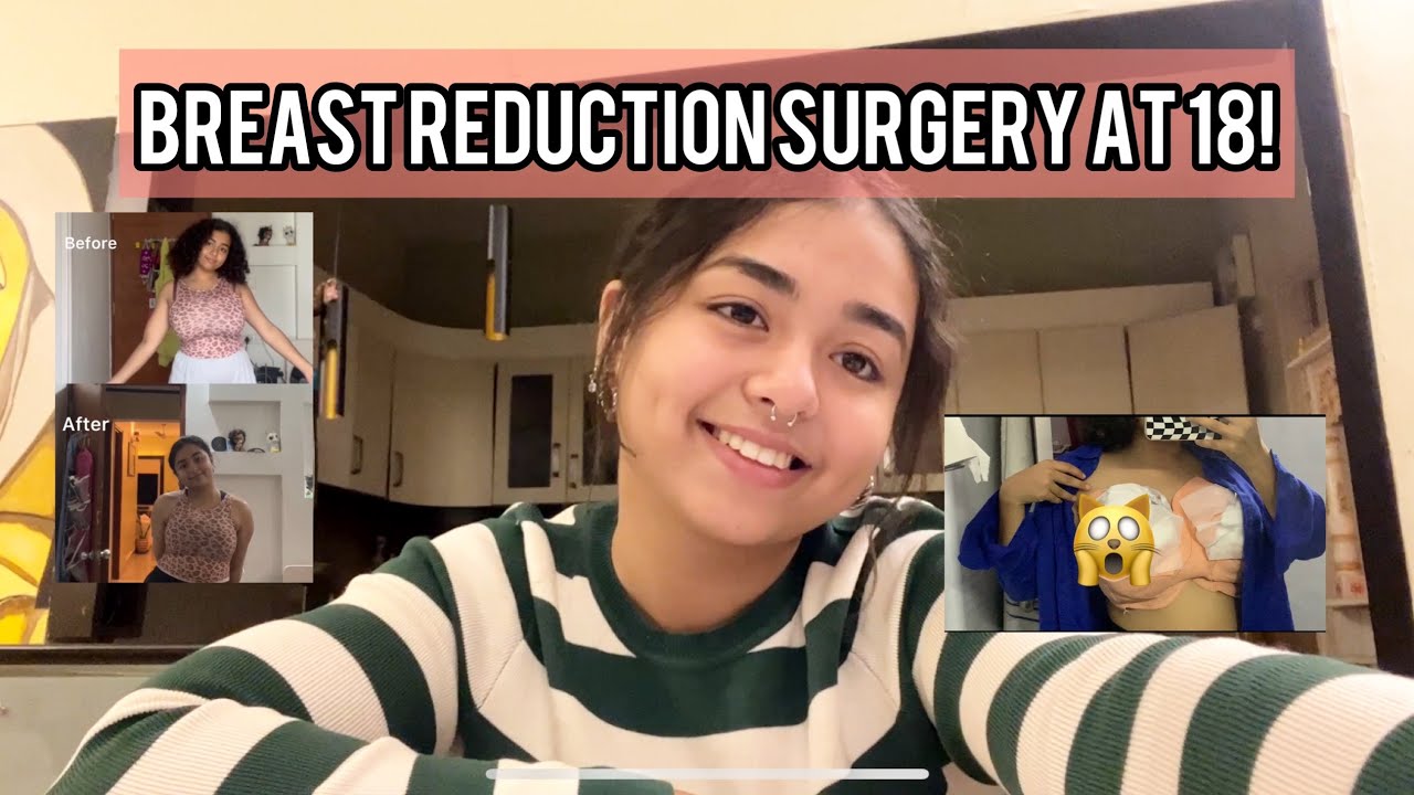 BREAST REDUCTION SURGERY IN INDIA!! |Tanishka Vispi