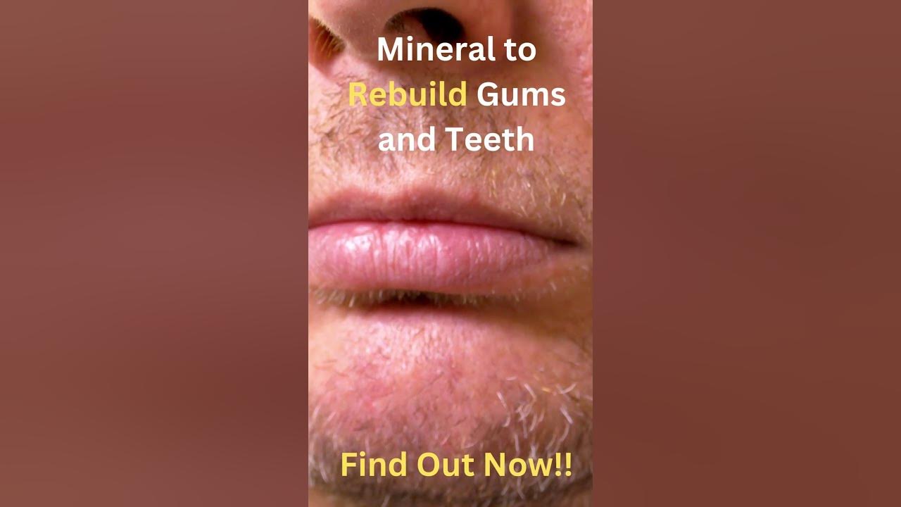 What Soft Mineral Rebuilds Gums And Teeth Smile Mineral to Rebuild Gums and Teeth Free Pdf - YouTube