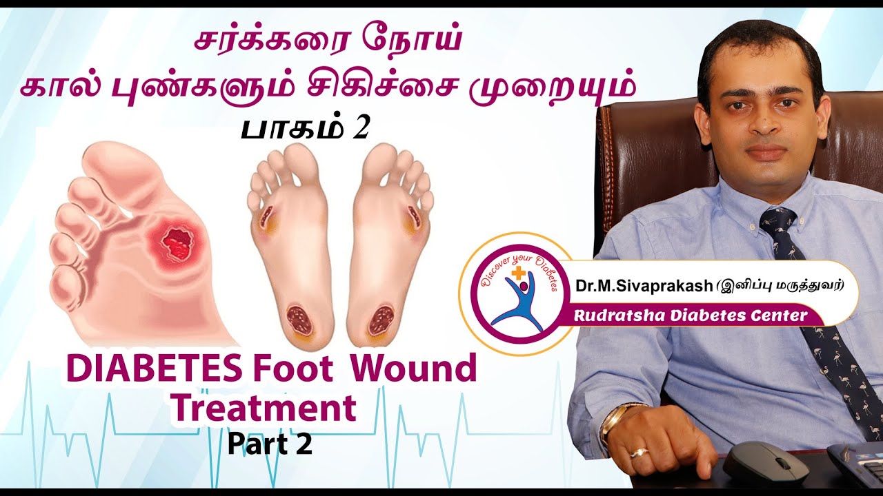diabetes-foot-wound-care-in-tamil-2020-part-ii-dr-sivaprakash