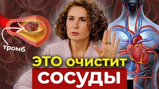 ТЫ ПРОЖИВЁШЬ МЕНЬШЕ, если у тебя есть ЭТА ПРОБЛЕМА с сосудами!