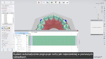 3Shape Clear Aligner Studio - Setup and Staging Assistance - Timeline PL