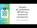 Пример: исследования ЗВПШП при начальной катаракте.