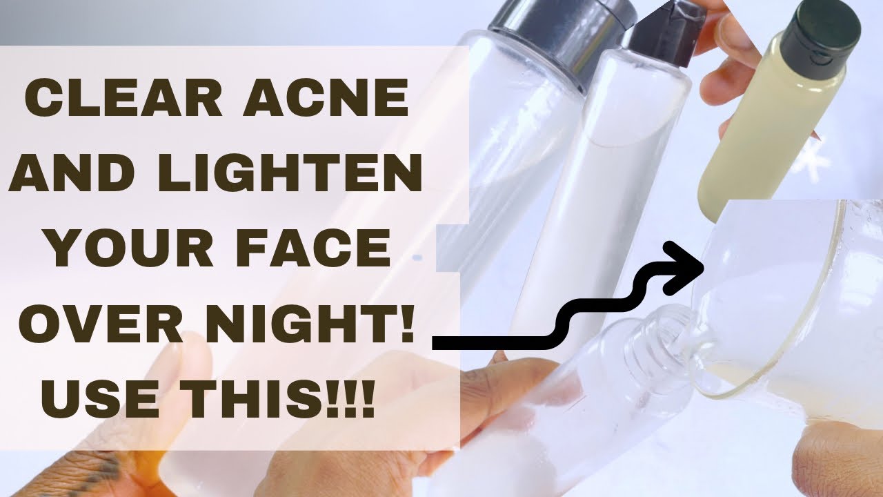 Как сделать тоник с салициловой кислотой для осветления кожи дома | 