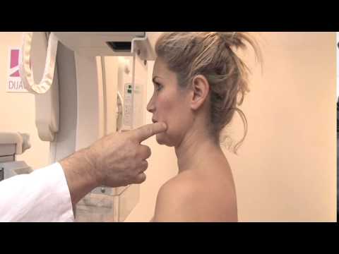 Video: ❶ Mamografija Dojke