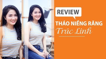 [Review tháo niềng răng]: #29 Kết quả niềng răng của Trúc Linh