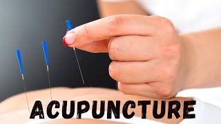 Is Acupuncture the Secret to Wellness? 12 Eye-Opening Facts!