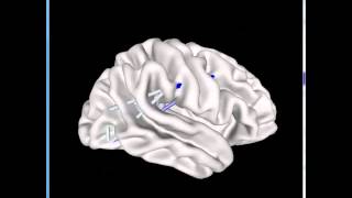 BrainSurferI&II
